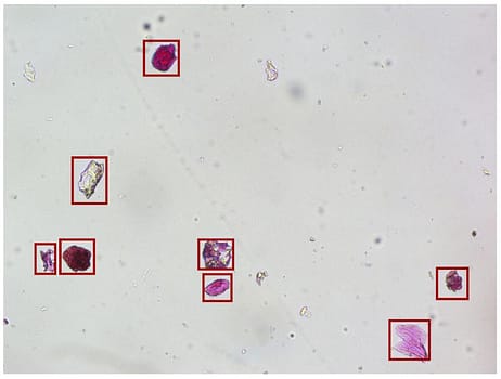 AI-Powered Magnetic Microplastic RemediationCombining Nanomaterials, AI & Microscopy for Sustainable Pollution Solutions01